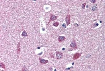 Immunohistochemistry-Paraffin: Kv1.3 Antibody [NBP3-14387]